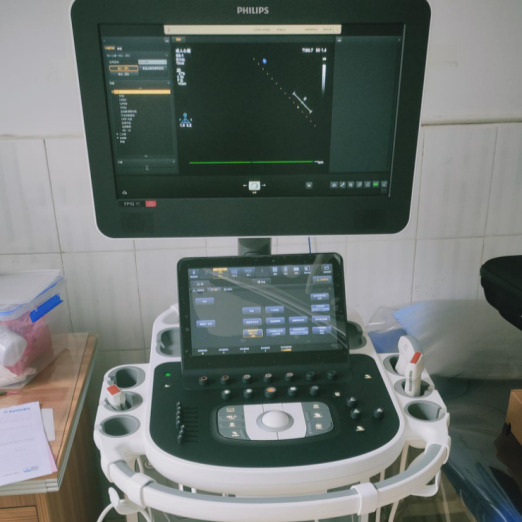 二手飞利浦 EPIQ 7C 超声回收